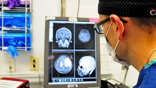 Un estudio de investigadores del University College London (UCL) describió 43 casos de pacientes con COVID-19 que sufrieron de disfunción cerebral temporal