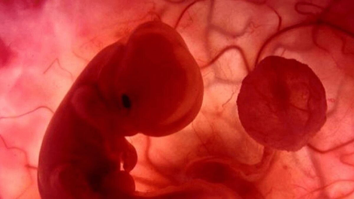 El feto había desarrollado algunos órganos y extremidades. Foto referencial